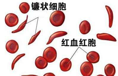 人體午夜成人福利电影廠家介紹檢測微量元素的儀器 人體午夜成人福利电影廠家介紹檢測微量元素的儀器