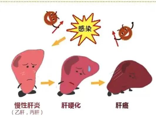 老司机午夜福利廠家提醒肝髒疾病治不好？要了解是否含鐵食物攝入多